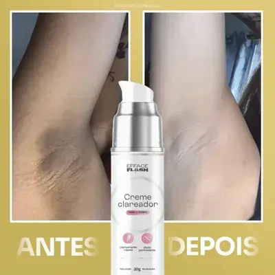 Antes e Depois Virilha